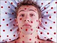 Корь может окончательно испортить детворе летние каникулы. В Луганской области заболели уже 22 человека